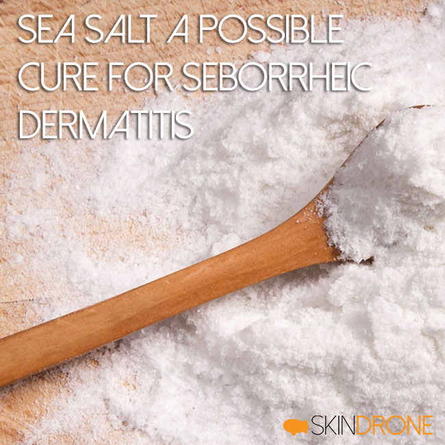 Sea Salt a Possible Cure for Seborrheic Dermatitis