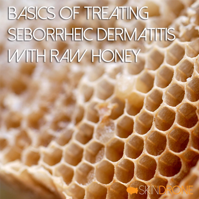 Basics of Treating Seborrheic Dermatitis with Raw Honey Cover Photo