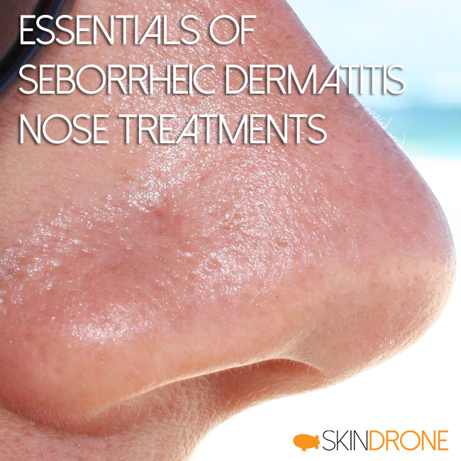 Essentials of Seborrheic Dermatitis Nose Treatments Cover Art